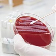 Methicillin-Resistant Staphylococcus aureus (MRSA) - Thumbnail