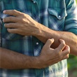 Scabies - Thumbnail