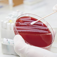 Methicillin-Resistant Staphylococcus aureus (MRSA): thumbnail