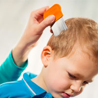 Head Lice: thumbnail